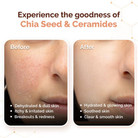 Mamaearth Chia Calming Moisturizer with Chia Seed & Ceramides for Healthy Skin Barrier | For Hydrated Glow | Co-Created with Dermats | For Dry & Sensitive Skin | 24H Long Lasting Moisturization | Fragrance Free | 80 g