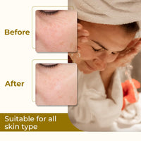 Passion Indulge Natural Handmade Bath Bar Soap - Turmeric (Pack of 3)