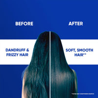 Head & Shoulders 2-in-1 Smooth and Silky Anti Dandruff Shampoo + Conditioner for Women & Men, With Almond Milk (1 L)