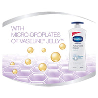 Vaseline Derma Care Advanced Repair Body Lotion|For Sensitive Dry Skin| Non Greasy|Long Lasting Moisturisation|400 ml
