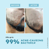 Hyphen Clarifying Acne Face Wash for Women and Men | Cleanser For Acne Prone Skin with Salicylic Acid 2%, Zinc PCA, Witch Hazel 10% | Anti-Acne Face Wash for Oil Control, Pore Cleasning | Antibacterial & Non-Drying Formula - 100ml