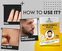 UrbanGabru Acne Pimple Patch - 72 Invisible Facial Stickers | Active Acne Absorbing Patch | Reduces Pimple Overnight | Reduces Excess Oil | For All Skin Types