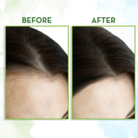 Mamaearth Rosemary Essential Oil for Hair Growth - 15 ml | 100% Pure & Natural | Undiluted | For Hair Fall Control & Hair Strengthening