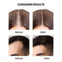 ThriveCo Rosemary Essential Oil For Hair Growth & Hair Fall Control | Reduces Hair Breakage & Improves Scalp Health | 100% Pure, Certified Organic & Natural | With Vitamin E | For Men & Women | 15ml