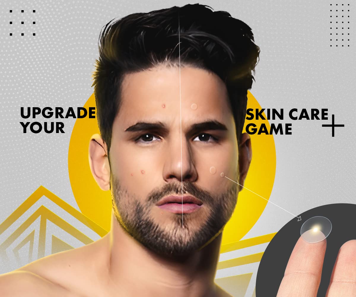 UrbanGabru Acne Pimple Patch - 72 Invisible Facial Stickers | Active Acne Absorbing Patch | Reduces Pimple Overnight | Reduces Excess Oil | For All Skin Types