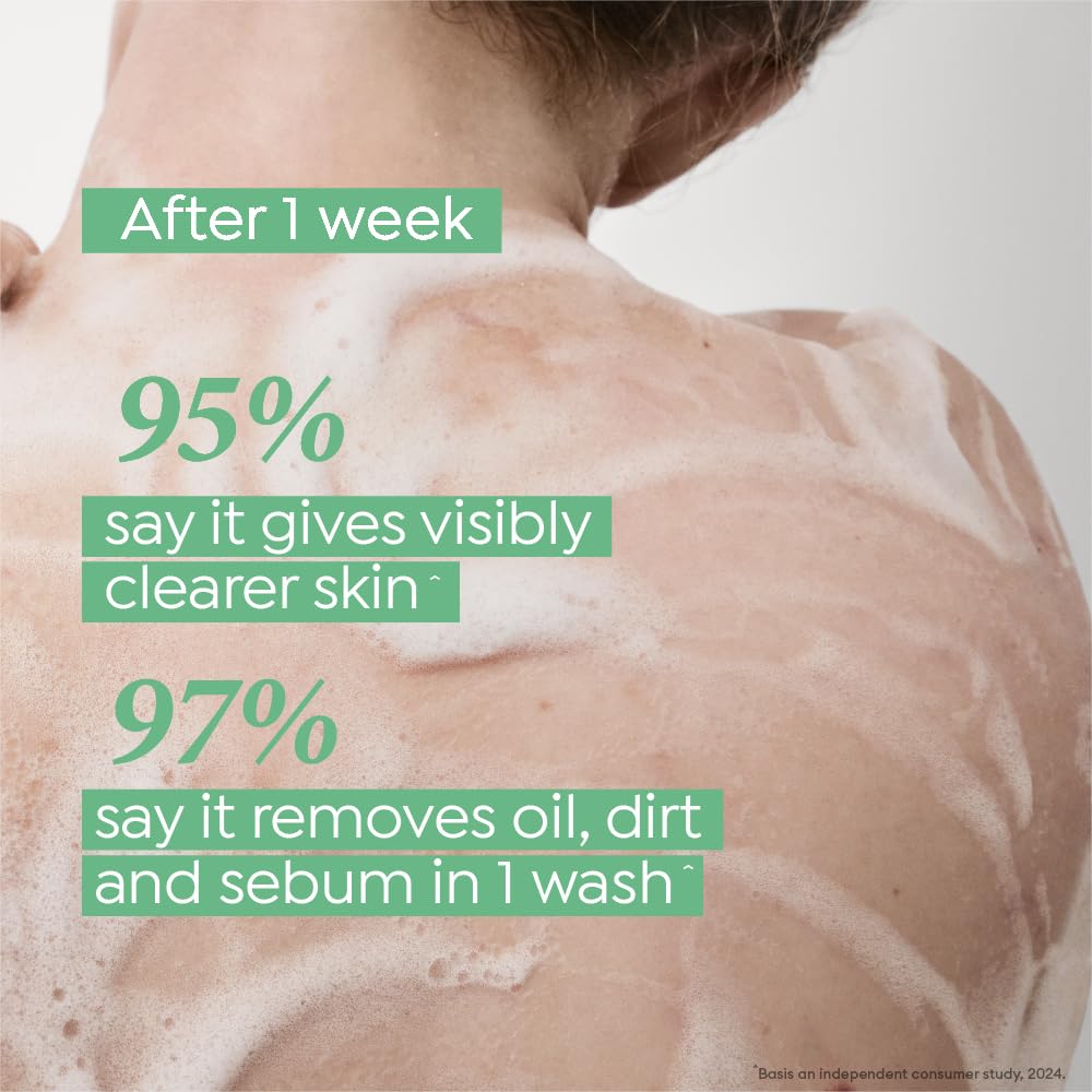 Dove Acne Clear Serum Body Wash|1% Salicylic Acid Formula| Clears and helps prevent acne | Paraben & SLS free | 300 ml