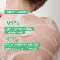 Dove Acne Clear Serum Body Wash|1% Salicylic Acid Formula| Clears and helps prevent acne | Paraben & SLS free | 300 ml