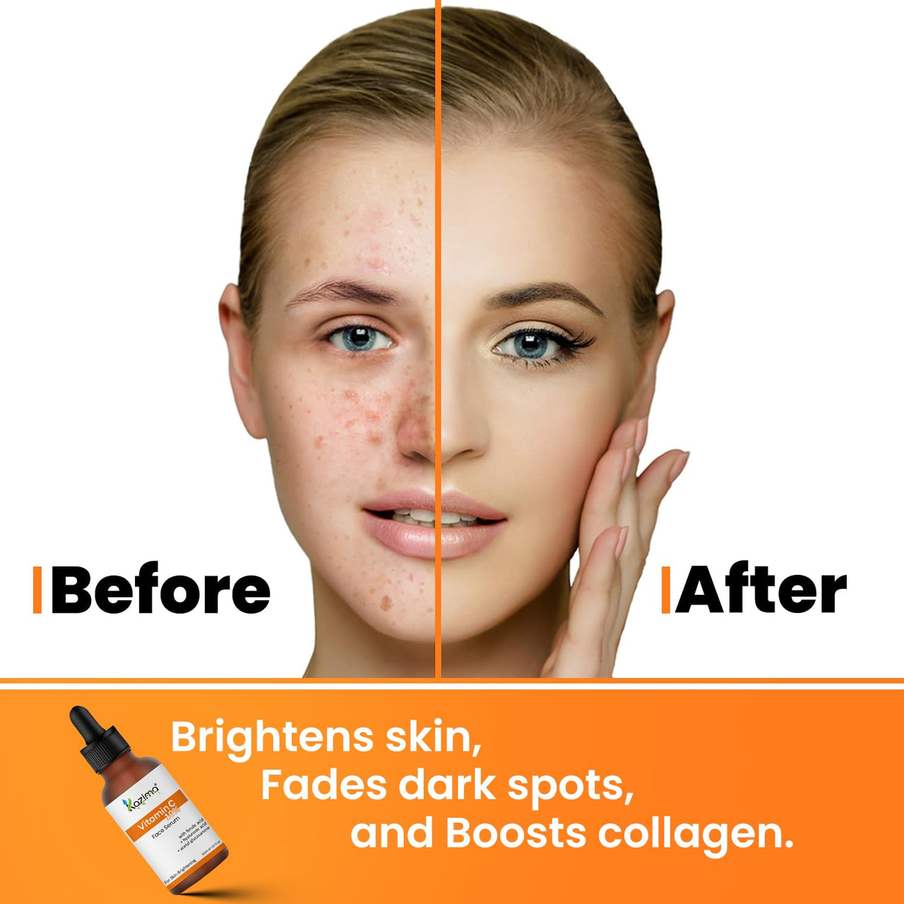 KAZIMA 10% Vitamin C Face Serum for Glowing Skin with 0.5% Ferulic Acid | Targets Dark Spot & Hyperpigmentation | For Dull Skin | Vitamin C Serum for Oily Skin | Suitable for Men & Women | 30 ml