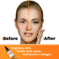 KAZIMA 10% Vitamin C Face Serum for Glowing Skin with 0.5% Ferulic Acid | Targets Dark Spot & Hyperpigmentation | For Dull Skin | Vitamin C Serum for Oily Skin | Suitable for Men & Women | 30 ml