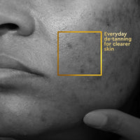 VLCC Clinic Skin Clarifying De-Tan Face Wash - 150ml | Anti-Tan Face Wash | Glycolic Acid & Vitamin C Facewash | Anti-Blemish Properties, Targets Dead Skin Cells and Pigmentation