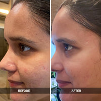 LuxaDerme Pore Perfecting Face Serum - Minimizes Pores, Controls Oil & Sebum, Firms Skin | 96% Natural Ingredients with Lotus water, Alpaflor® Alp-Sebum, Syn®-Coll, Galactomyces | Korean Skincare - 30ml