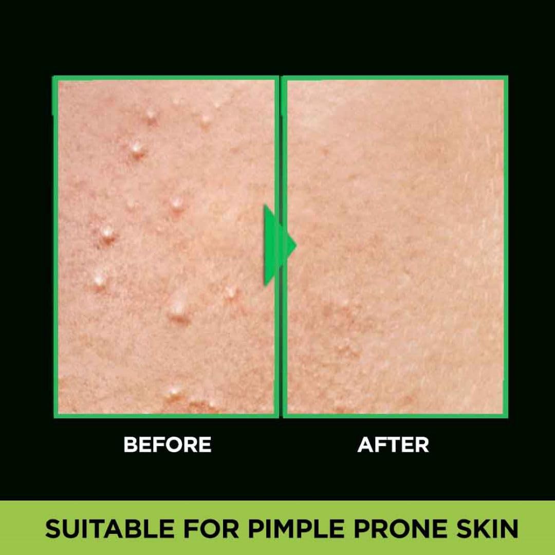 Garnier Men, Anti-Pimple Face Wash, Repairs Skin & Balances Oils, AcnoFight, 100 g (Pack of 5)