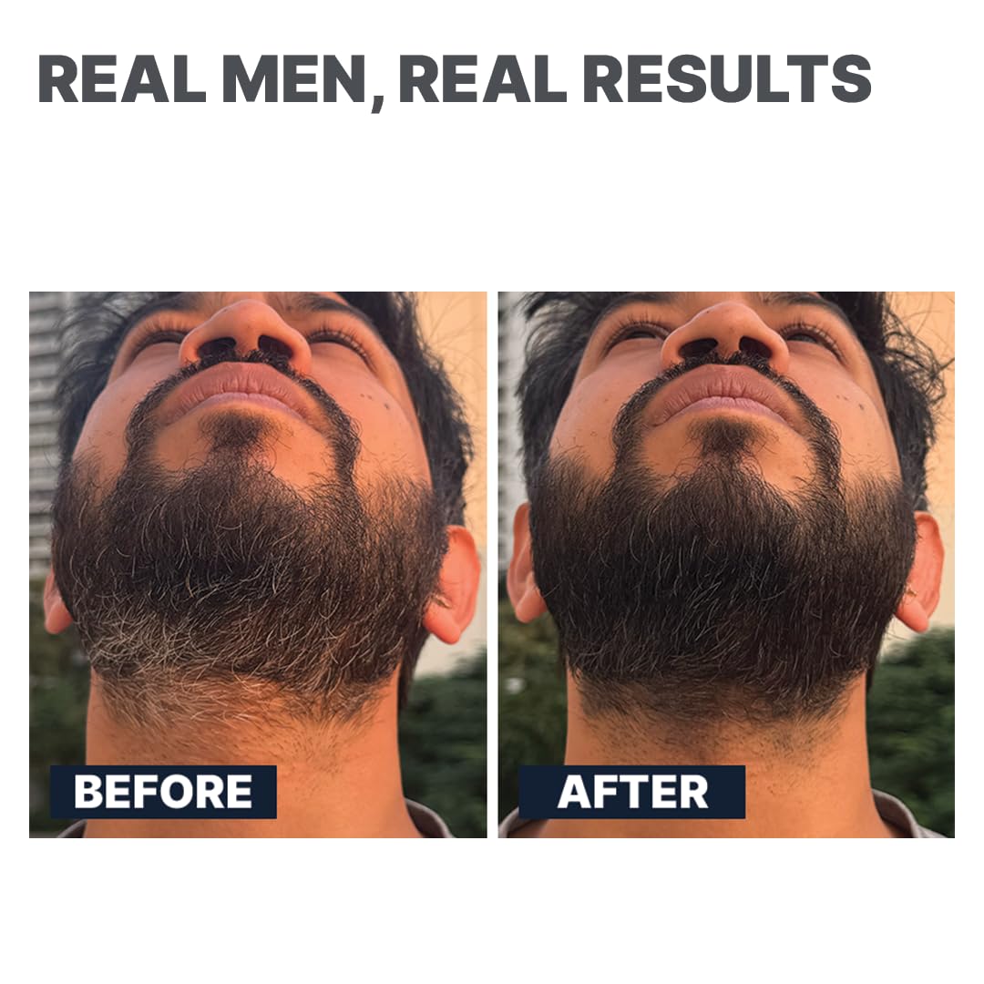ALL MAN 24-Hours Instant Grey Cover, Temporarily Cover Grey Hair, Sweat & Waterproof | Beard & Short Hair | Natural Black | 10g