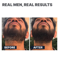 ALL MAN 24-Hours Instant Grey Cover, Temporarily Cover Grey Hair, Sweat & Waterproof | Beard & Short Hair | Natural Black | 10g