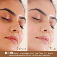 Richfeel Calendula Anti Acne Brightening Soap | Bathing Soaps | Bath Soap for Men & Women | Soaps for Bath | TFM Grade 1 Soap | For Oily Skin | Fades Dark Spots | - 75Gm X 4 (B3G1) Pack of 4