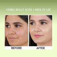 Aravi Organic Green Tea Night Gel Moisturizer - For Overnight Hydration - For Anti-Aging Oil Free Gel Moisturizer -For Men & Women - 50 gm