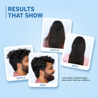 Plum Coconut Shampoo for Dull Hair with Coconut Milk and Peptides for Strong & Shiny Hair I 22x shine I Soft, silky hair I Shampoo for Women and Men | SLS sulphate and paraben free shampoo I 250ml (Pack of 2)