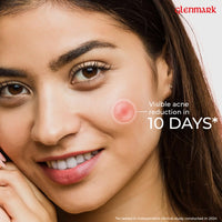 D’Acne Soft Face Wash | Unclogs pores and prevents pimples | Stops recurrence of acne | Contains 1% Glycolic Acid, Niacinamide |Suitable For Oily skin, Acne-prone Skin | Men & women | 100 ml