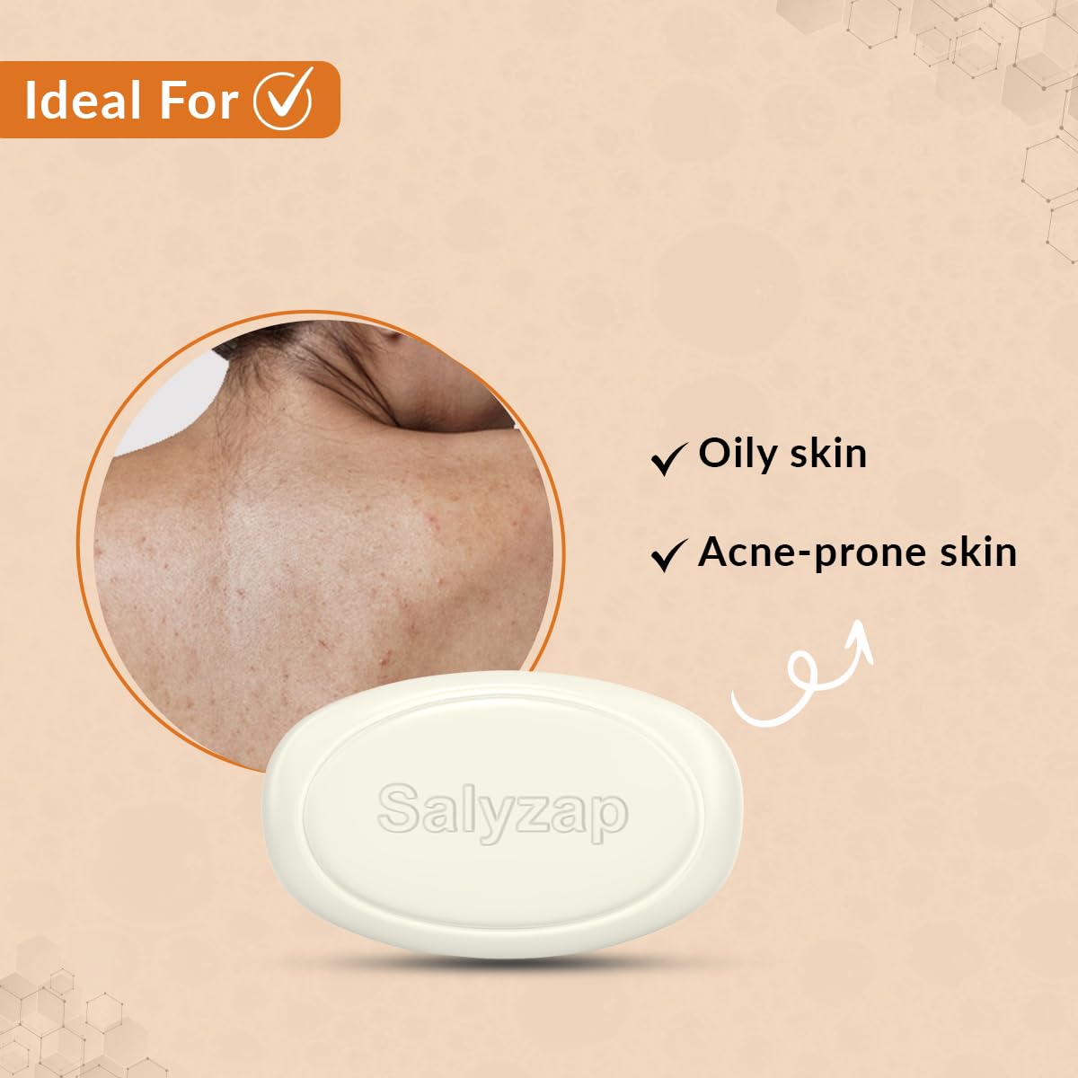 Fixderma Salyzap Soap with Salicylic Acid, Tea Tree Oil & Vitamin E | Acne Soap for Acne-Prone & Oily Skin (75, Salicylic Acid)