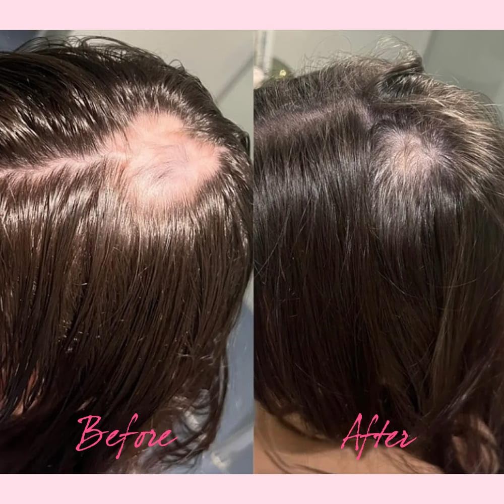 Vagmine Hair Growth Serum Plus With Biotin 5% & Rosemary - 60ml | Natural Treatment for Stronger, Thicker Hair | Promotes Healthy Hair Growth | Nourishes Scalp & Helps in Reduces Hair Fall