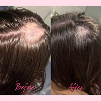 Vagmine Hair Growth Serum Plus With Biotin 5% & Rosemary - 60ml | Natural Treatment for Stronger, Thicker Hair | Promotes Healthy Hair Growth | Nourishes Scalp & Helps in Reduces Hair Fall