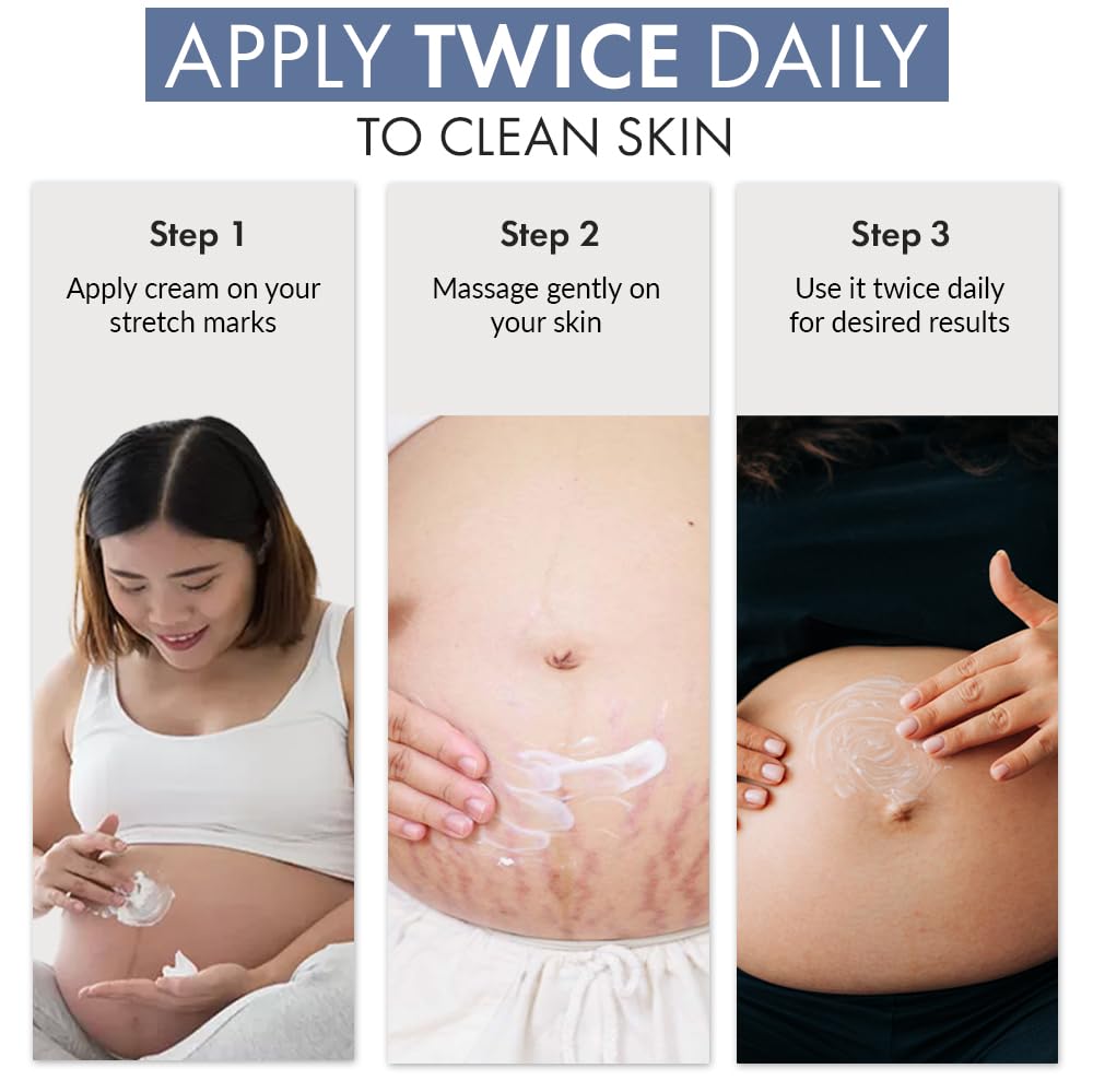 ThriveCo Stretch Marks Expert Serum Cream | For New (red) & Old (white) Stretch Marks Removal & Skin Hydration | Powered by Striover™, Rosehip Oil & Squalane | For Men & Women | 30ml