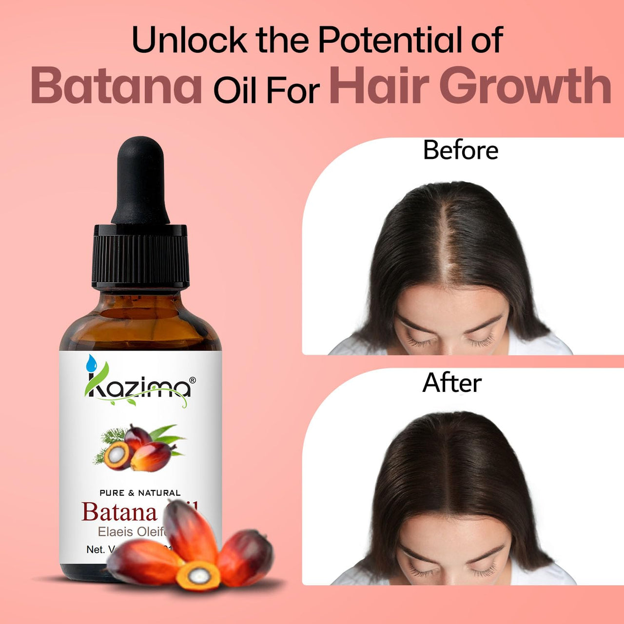 KAZIMA Batana Oil for Hair Growth | Pure Batana Oil Cold Pressed for Healthy Hair & Scalp | Promotes Stronger & Shiny Hair | 30 ml