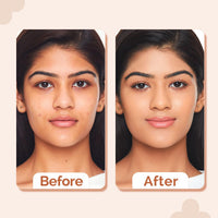 The Derma Co 2% Niacinamide High Coverage Matte Finish Foundation With 1% Hyaluronic Acid & Spf 40 Pa+++ For 12 Hour Long Stay & Oil Control - 05 Peach, For All Skin Type