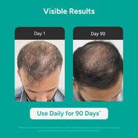 Arata Hair Growth Serum Concentrate with 3% Redensyl, 3% Procapil, 5% Kopexil, Caffeine and Rice Water | No Minoxidil Supports Hair Growth | Helps Reduce Hairfall | Serum For Women and Men | 30 ML