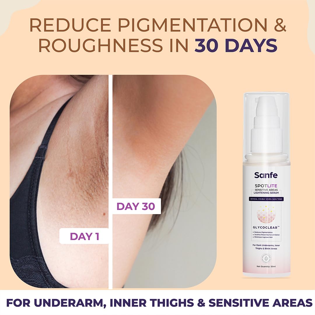 Sanfe Spotlite Body Kit | Lightens Overlooked Areas | Brightens Intimates | Non Toxic | 6 In 1 Glo Cream | Spotlite Serum