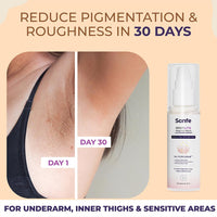 Sanfe Spotlite Body Kit | Lightens Overlooked Areas | Brightens Intimates | Non Toxic | 6 In 1 Glo Cream | Spotlite Serum