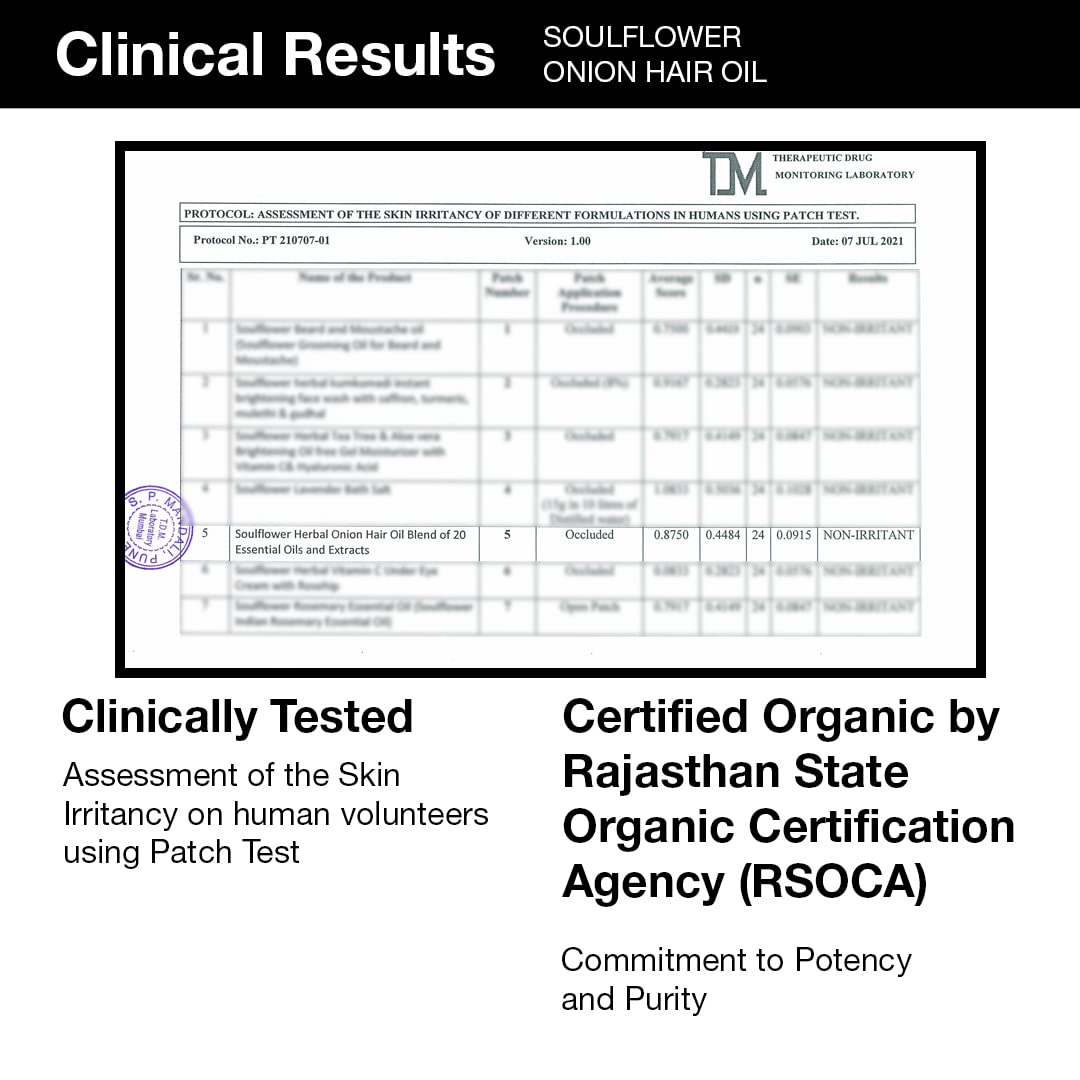 Soulflower Amla & Onion Hair Oil for Hair Growth & Hair Fall Control | 100% Pure & Natural with Castor, Peppermint, Argan Oil | Promotes Healthy Scalp & Stronger Hair for Men & Women | No Mineral Oil, 120ml