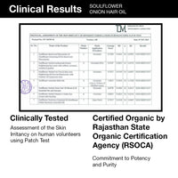 Soulflower Amla & Onion Hair Oil for Hair Growth & Hair Fall Control | 100% Pure & Natural with Castor, Peppermint, Argan Oil | Promotes Healthy Scalp & Stronger Hair for Men & Women | No Mineral Oil, 120ml