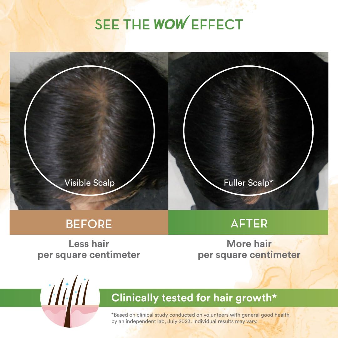 WOW Skin Science Rosemary with Biotin Hair Growth Oil | Stimulates New Hair Growth | Controls Hair Fall & Reduces Hair Breakage | Gives Healthy Hair