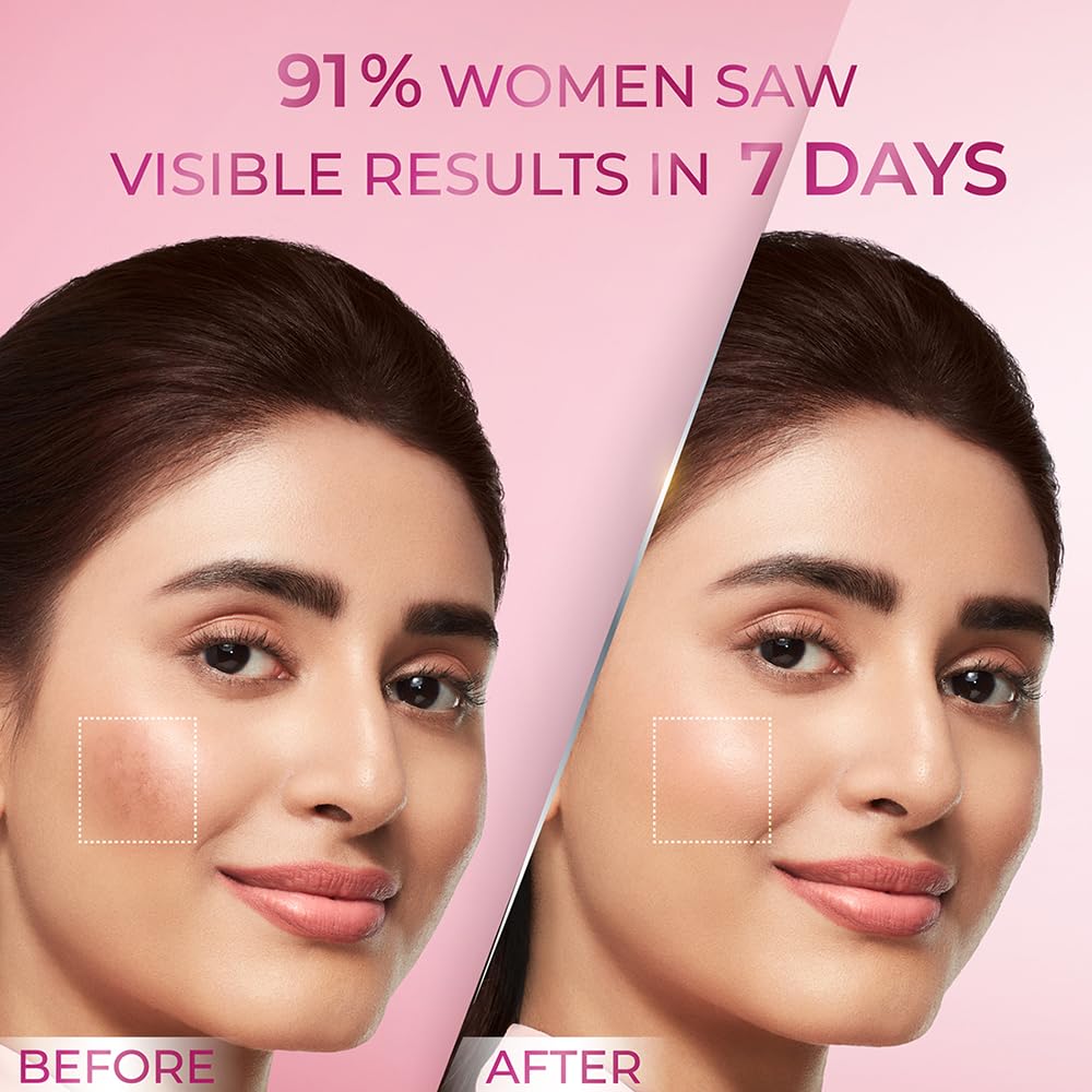 POND's Bright Beauty Anti-Pigmentation Serum For Flawless Radiance, 12% Gluta-Niacinamide Complex, Reduces Pigmentation, 28 Ml