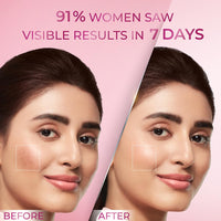 POND's Bright Beauty Anti-Pigmentation Serum For Flawless Radiance, 12% Gluta-Niacinamide Complex, Reduces Pigmentation, 28 Ml