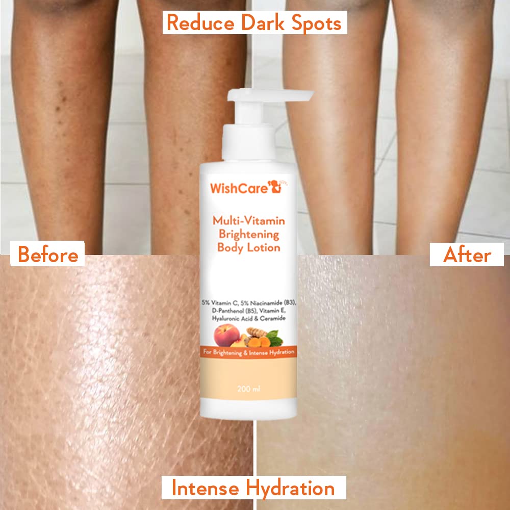 WishCare Multi-Vitamin Brightening Body Lotion - 5% Vitamin C, 5% Niacinamide(B3), Panthenol(B5), Vitamin E, Turmeric & Kakadu Plum - For Men & Women - 200 Ml