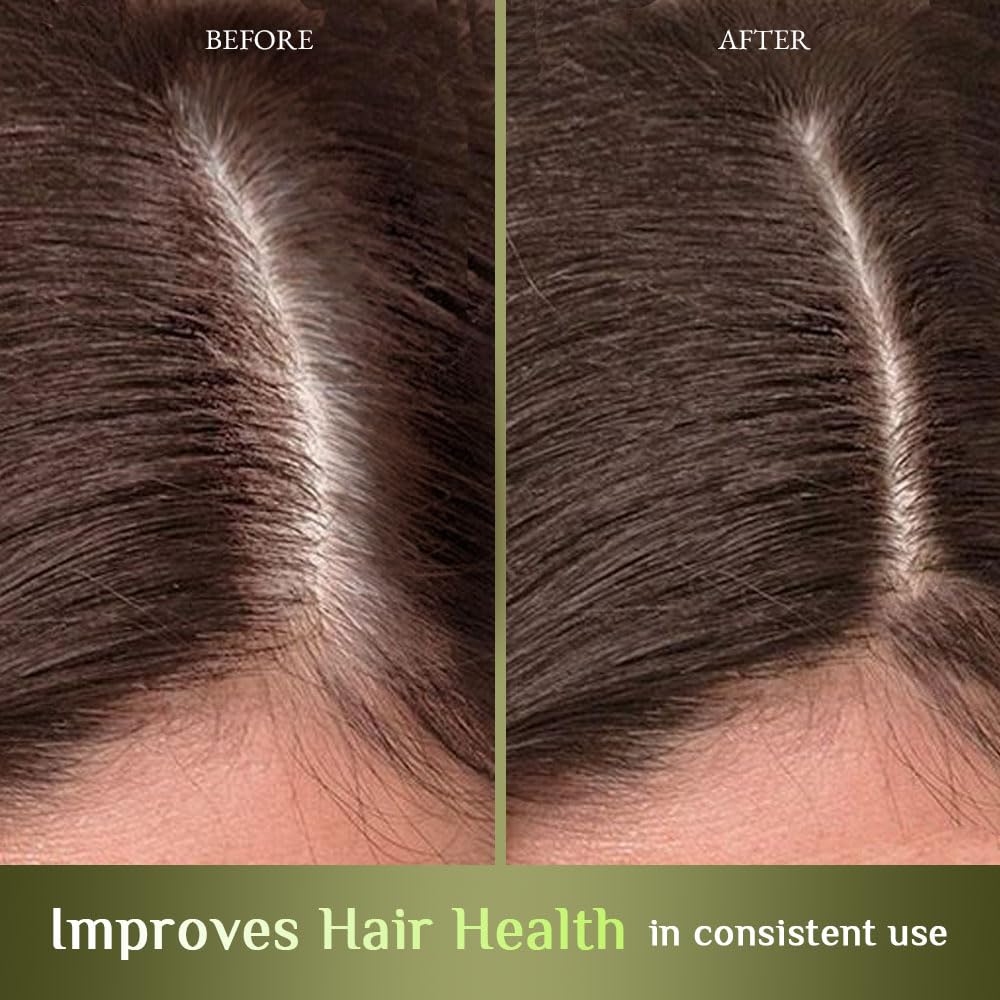 Richfeel Hair Root Nourisher/Tonic | For Hair Fall Control | Hair Growth Treatment | Trichologist Developed Formula | High Concentration | Oil & Silicone Free | 80 ML