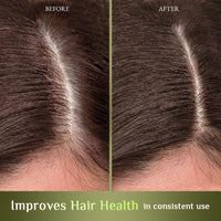 Richfeel Hair Root Nourisher/Tonic | For Hair Fall Control | Hair Growth Treatment | Trichologist Developed Formula | High Concentration | Oil & Silicone Free | 80 ML