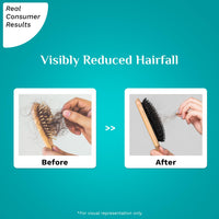 Pilgrim RootActive Anti-Hairfall Serum With Spanish Rosemary, Caffeine, Biotin, Capilia Longa, Saw Palmetto (30ml) | Strengthens Hair Roots, Reduces hair loss & Increases Hair Density | For Men and Women