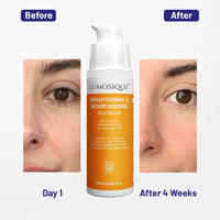 LUMOSIQUE® Brightening And Moisturizing Face Serum for Hydrates, Brightens & Evens tone Skin, Boosts Collagen & Corrects Hyperpigmentation | Oily, Dry, Sensitive & Combination Skin | MEN & WOMEN, 30ml