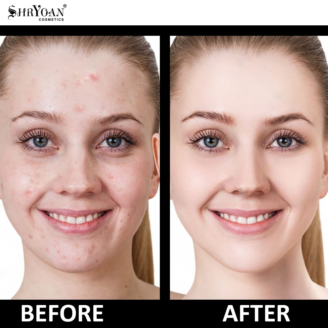 Shryoan Hydra-boost High Coverage Foundation| For Long Lasting Glow & Matte Finish with Full Coverage Foundation (30gm)