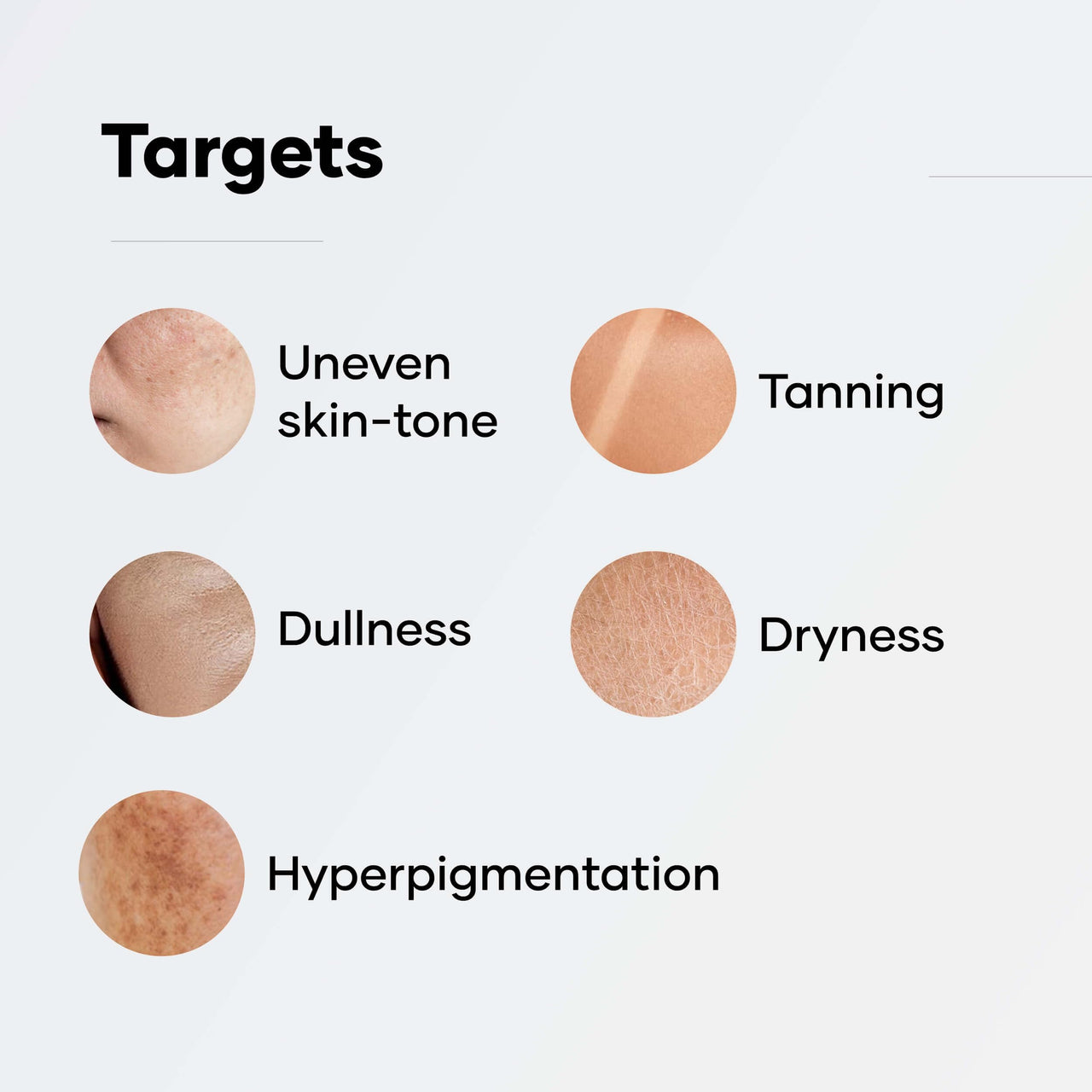 Cureskin Radiance Body Soap | For Pigmentation & Sun Damage with Alpha Arbutin, Kojic Acid and Ucuba Butter | Kojic Soap for Men & Women | Kojic Acid Soap for Skin Whitening | Soap Tan Removal, 75 g (Pack of 1)