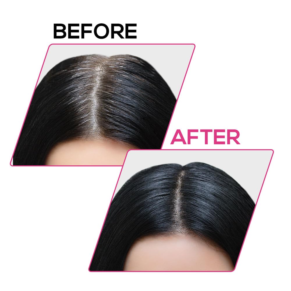 RENEE Cover-Up Hair Powder- Black, Helps Cover Grey Roots & Bald Spots Instantly, Highly Pigmented, Fuller and Denser, Long-Lasting & Matte Finish, Fine Powder for Flawless Application, 4gm