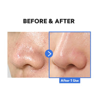 TIRTIR Hydro Boost Enzyme Cleansing Balm | Deep Cleansing Makeup Remover with Papaya & Pineapple Enzymes | Moisturizing, Exfoliating Balm for Dry, Sensitive & Oily Skin_120 ml