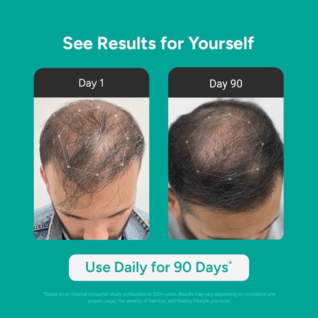 Arata Intensive Hair Growth Serum for Men & Women | 3% Redensyl, 3% Procapil & 5% Kopexil | Onion, Turmeric & Rice Water | Controls Hair Fall, Boosts Hair Growth & Strengthens Hair | Pack of 2 (60ml)