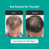 Arata Intensive Hair Growth Serum for Men & Women | 3% Redensyl, 3% Procapil & 5% Kopexil | Onion, Turmeric & Rice Water | Controls Hair Fall, Boosts Hair Growth & Strengthens Hair | Pack of 3 (90ml)