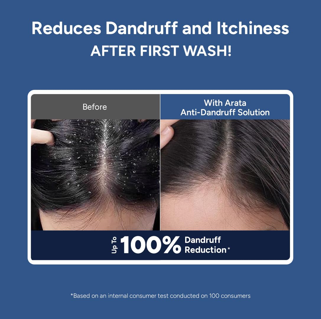 Arata Anti-Dandruff Shampoo for Women and Men I With Piroctone Olamine |Up To 100% Dandruff Reduction I Soothes Dry Flaky Scalp and Itching I Ideal For Dandruff Cure | 200 ML
