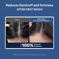 Arata Anti-Dandruff Shampoo for Women and Men I With Piroctone Olamine |Up To 100% Dandruff Reduction I Soothes Dry Flaky Scalp and Itching I Ideal For Dandruff Cure | 200 ML