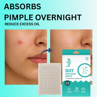 BAKE 2% Salicylic Acid Hydrocolloid Pimple Patches (72 Dots) | Absorbs Oil, Prevents Acne | Waterproof Patches | For Acne, Acne Marks, Acne Prone Skin - 72 Patches